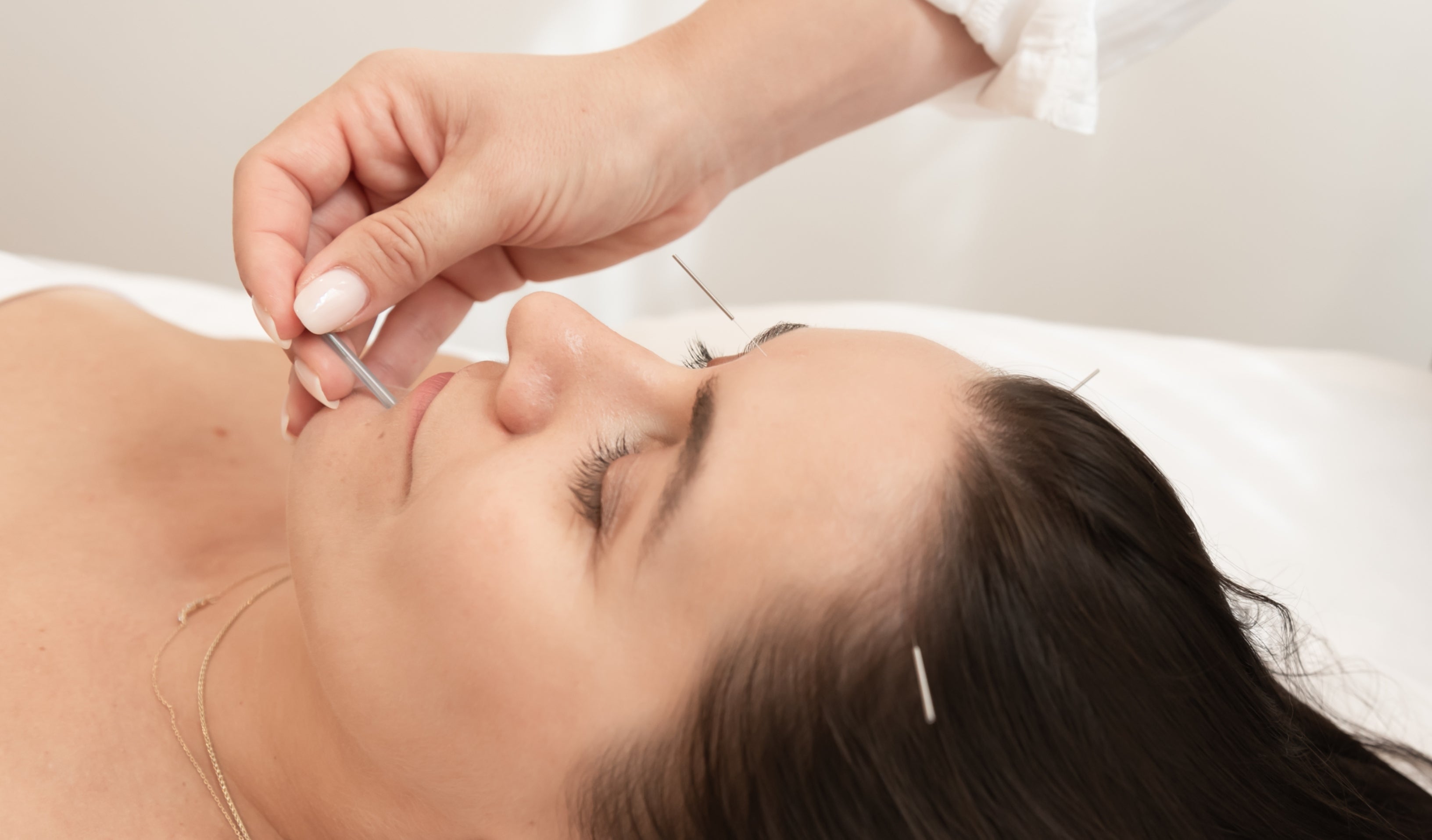 Beauty Benefits of Facial Acupuncture for anti-aging, helps to combat acne, wrinkles and fine lines and give you healthy glowing skin on taila skincare's blog. Holistic beauty using Traditional Chinese Medicine 